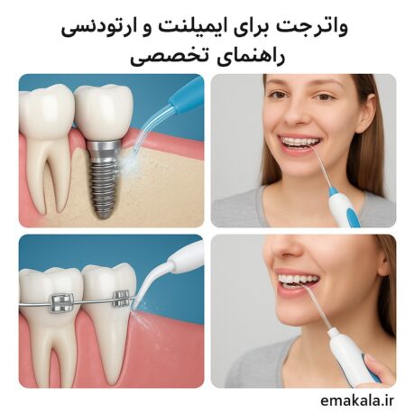 واتر جت برای ایمپلنت و ارتودنسی: راهنمای تخصصی برای لبخندی سالم‌تر